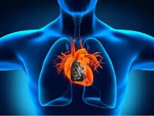 Andachtsbild von Unbekannt